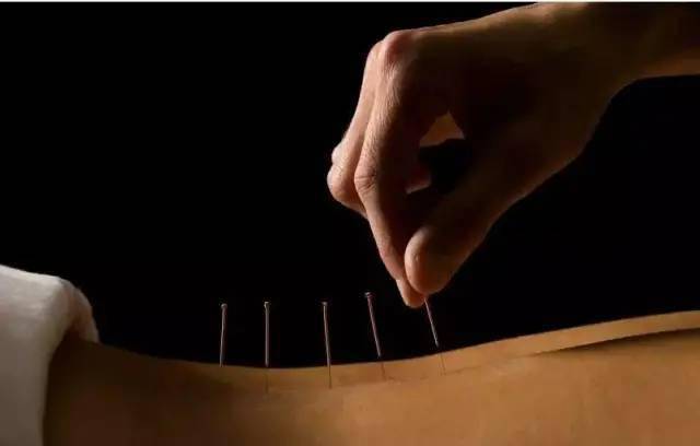 平衡针灸最新视频，现代应用探索针灸艺术的新境界