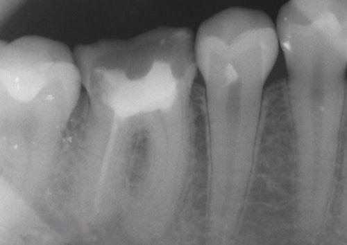 中国再生牙齿研究新进展,重塑微笑,科技引领牙齿再生新篇章