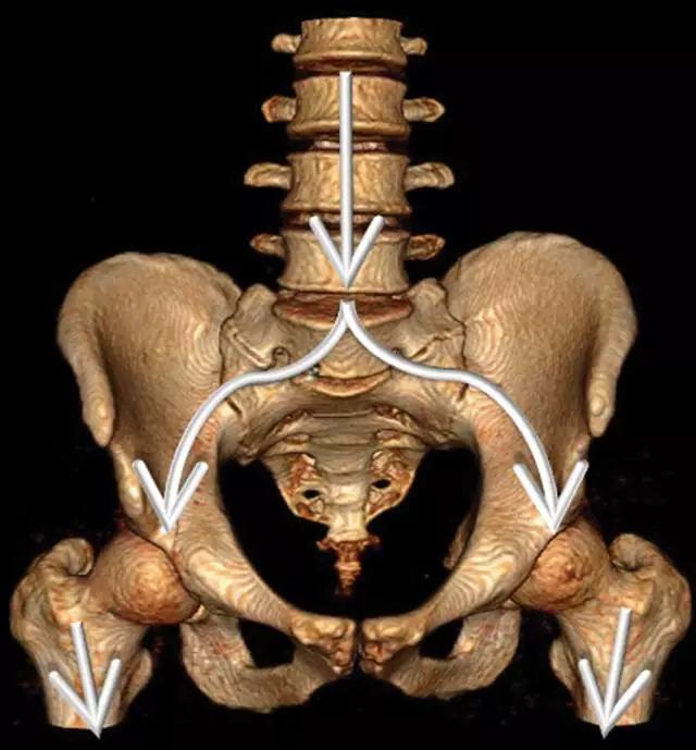 三维打印髋关节技术新动态,重塑生活的科技魔法奇迹