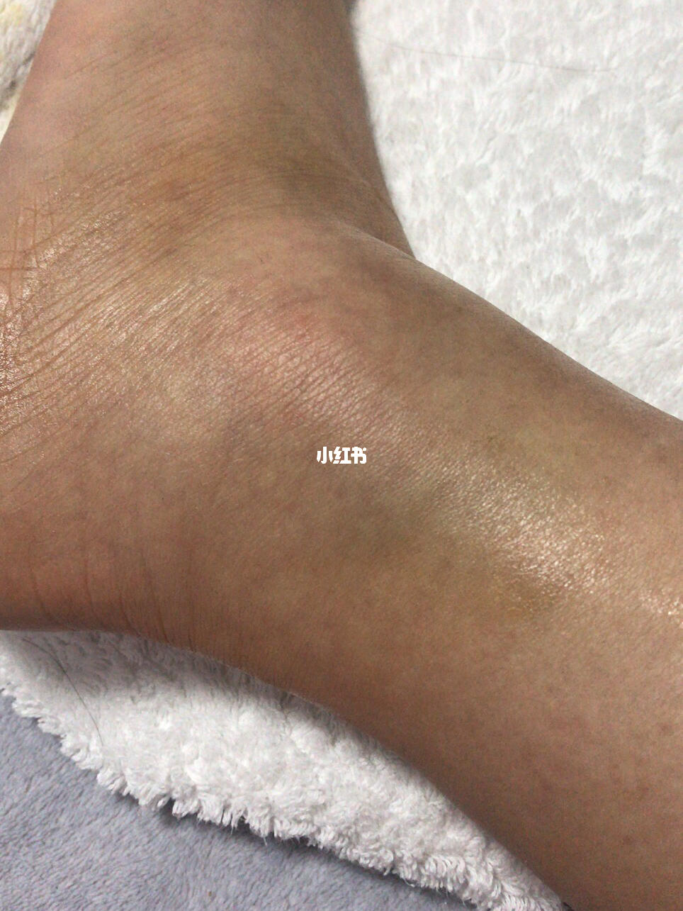 一次扭伤带来的自信与成就感,最新扭伤故事分享