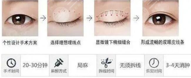 眼部整形最新技术揭秘