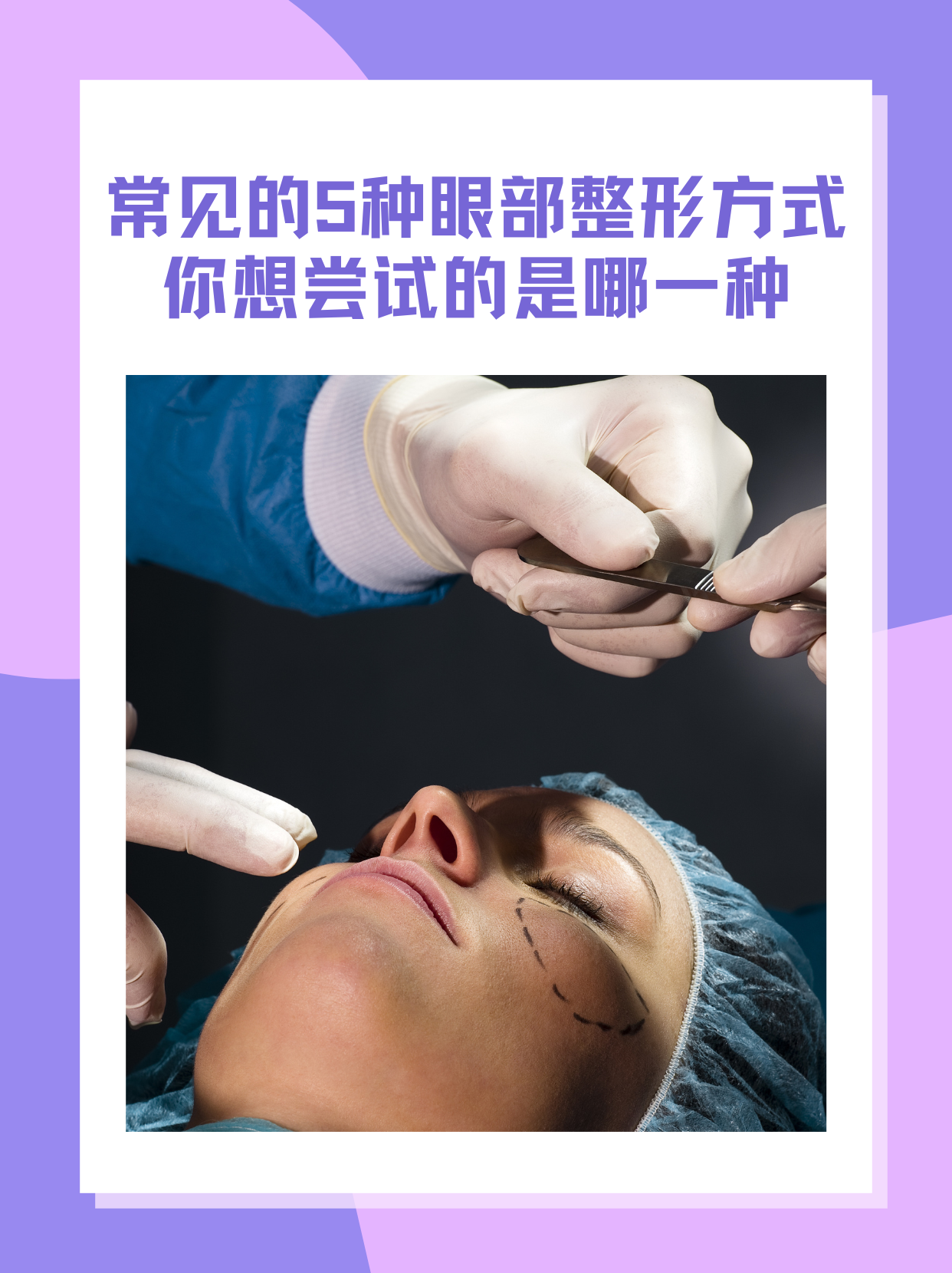 眼部整形最新技术揭秘