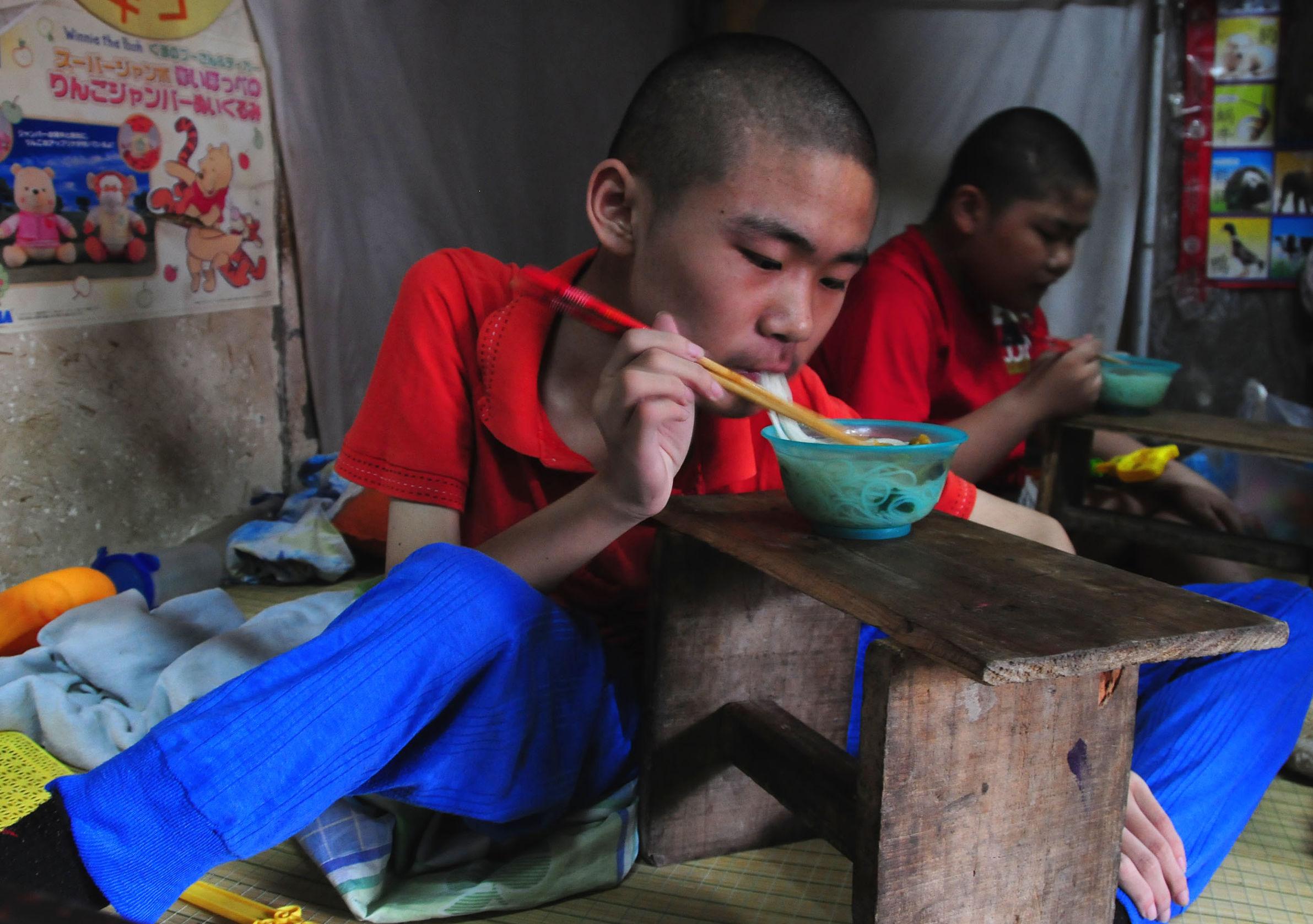 肌营养不良的最新治疗方法与研究进展