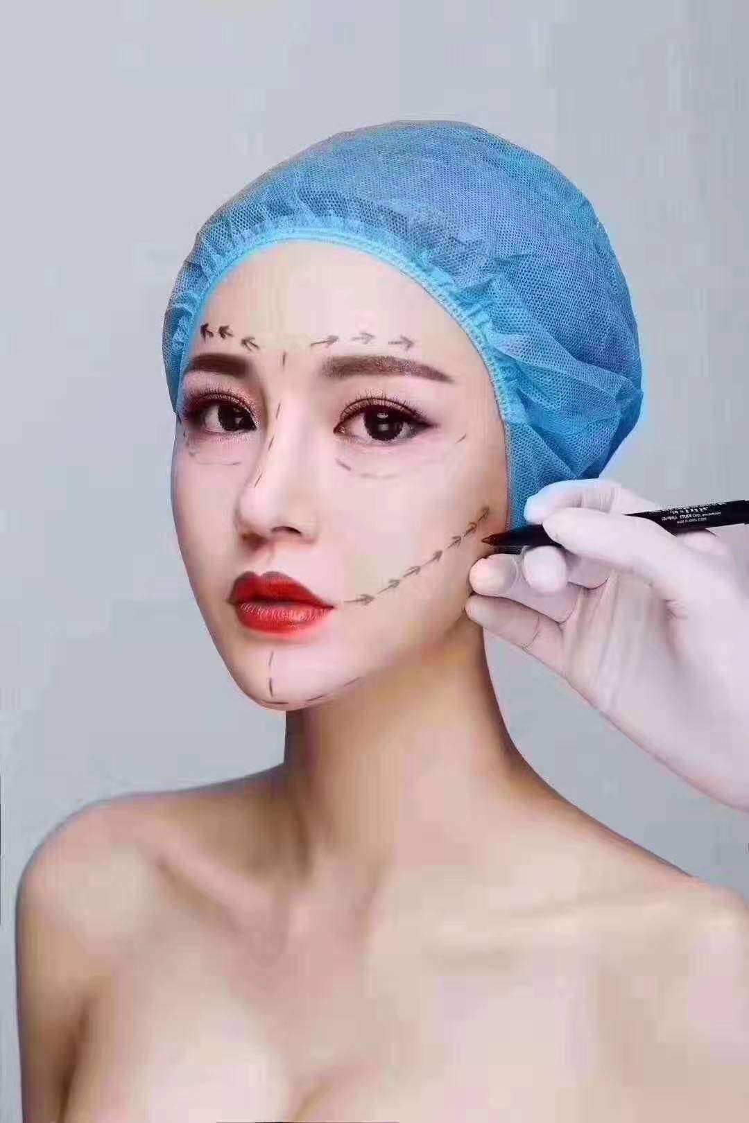 微整形新潮流,从细节之处开始改变的美貌革命