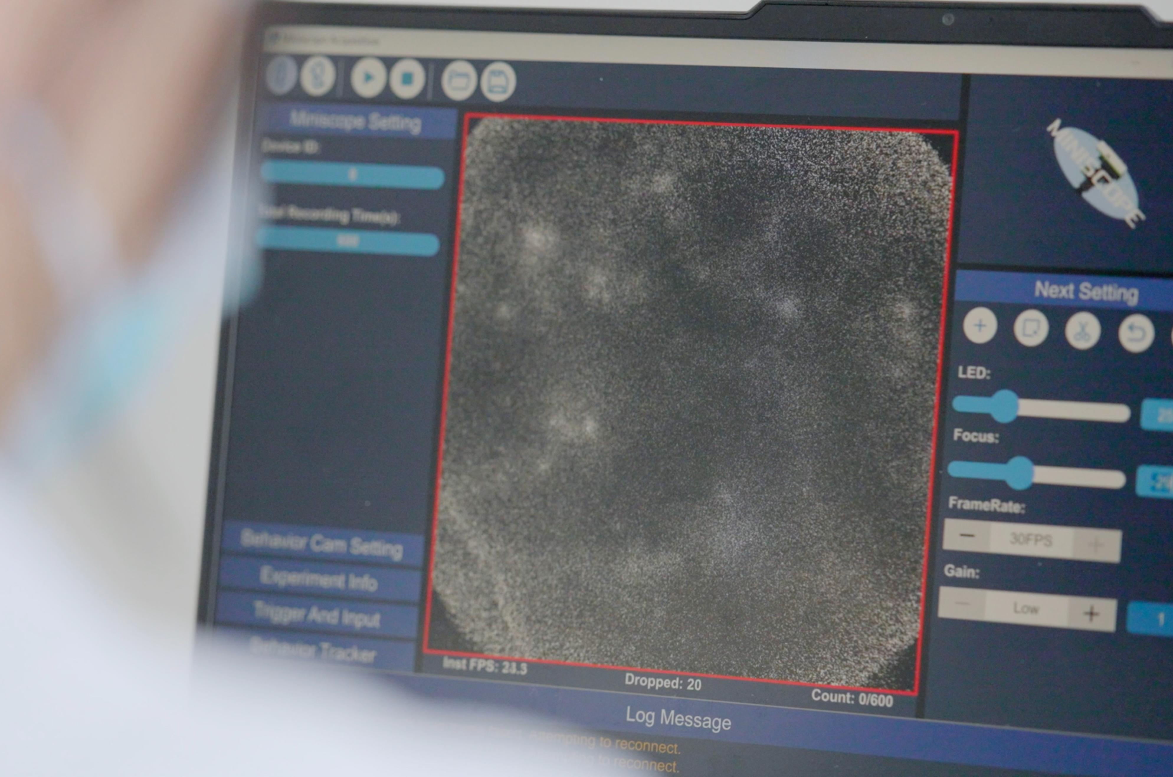 脑疾病最新研究,重塑大脑信心与成就感之路