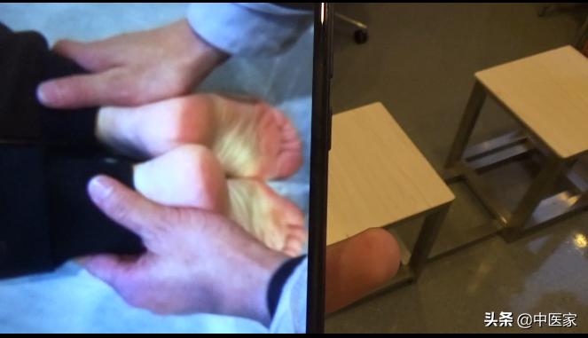 最新正骨视频,传统疗法的现代应用与发展