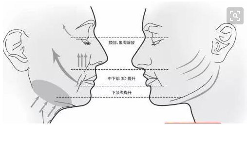 线雕最新手法,背景、发展、时代地位及展望